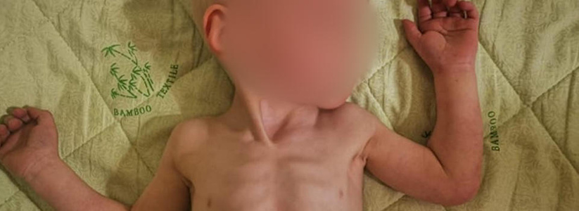 35-летняя мать заморила голодом своего четырехлетнего сына